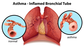 Porovnání  bronchiálních trubic